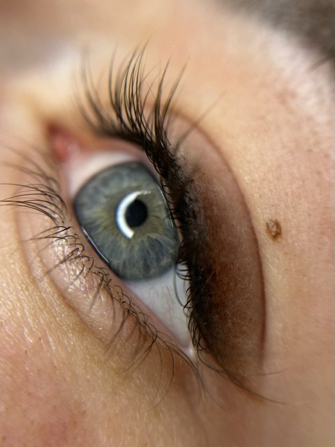 Lash line enhancement